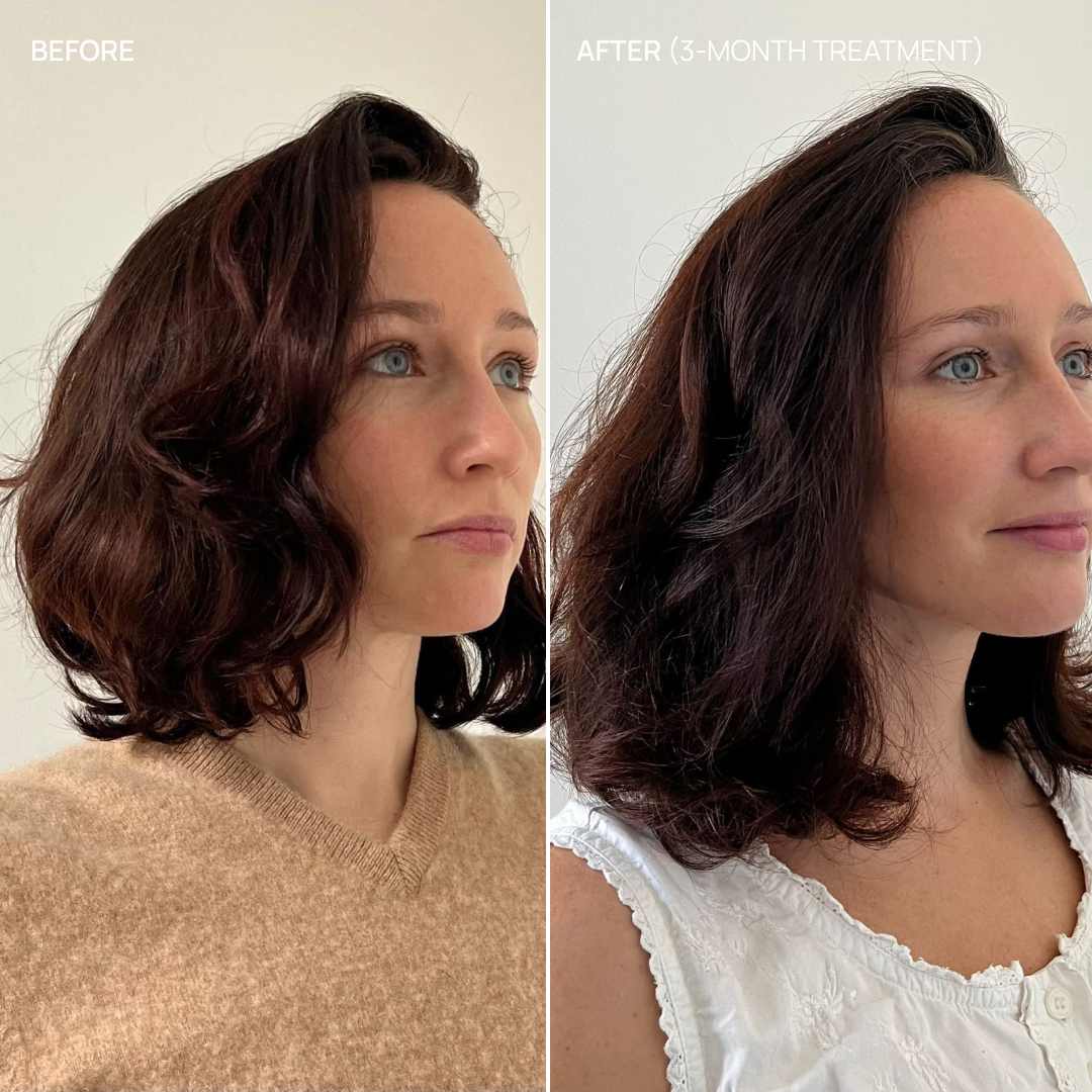 Complément alimentaire cheveux, Hair & Scalp Boost - Image 11
