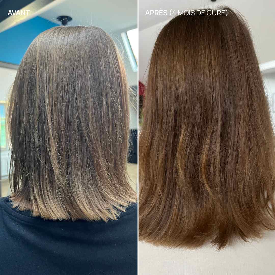 Complément alimentaire cheveux, Hair & Scalp Boost - Image 3