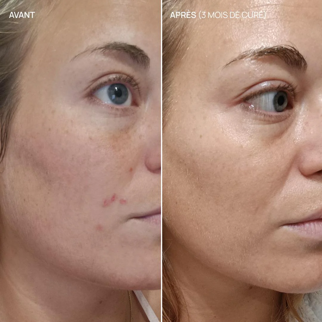 Complément alimentaire équilibre hormonal, Balance & Glow - Image 5