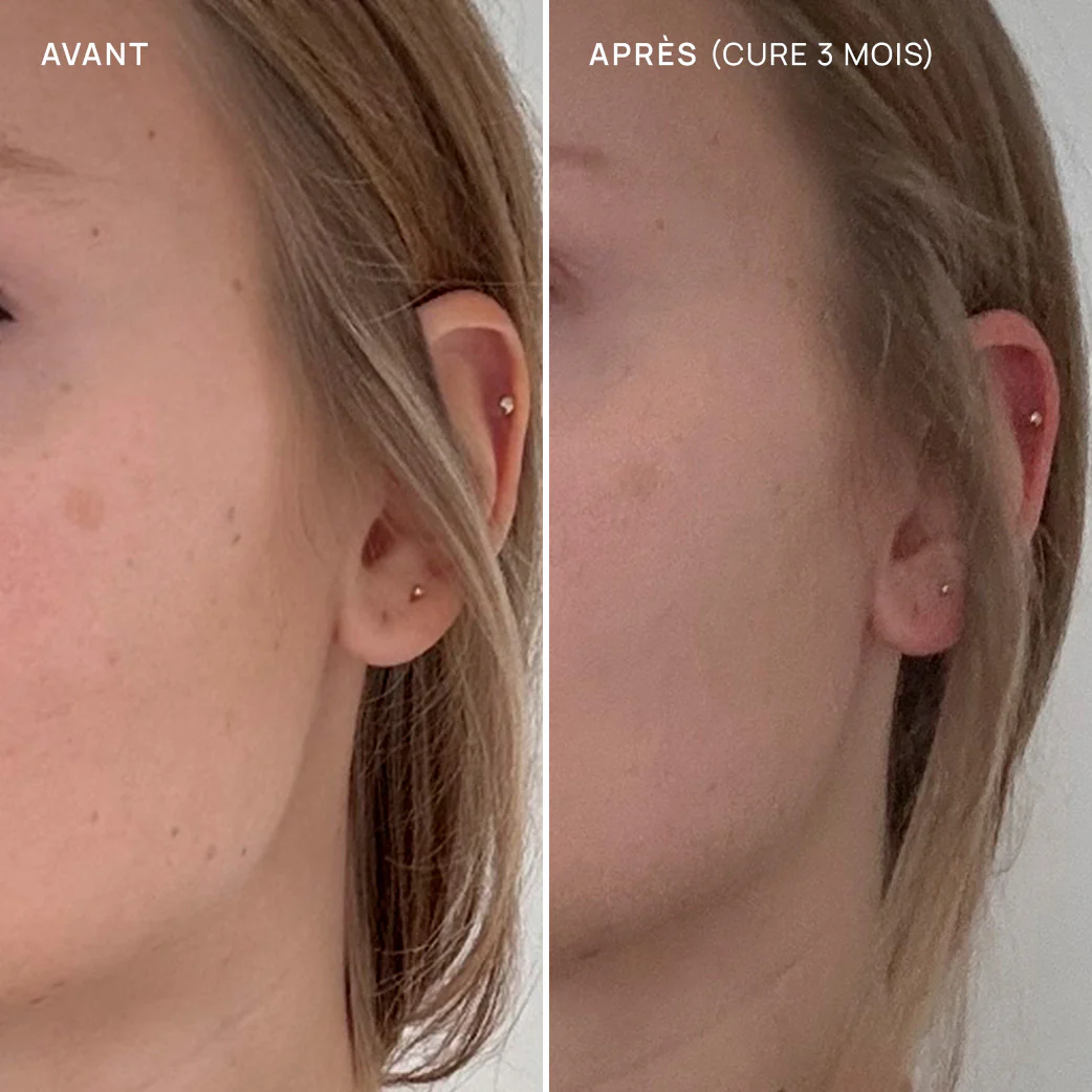 La routine anti-taches - Image 6