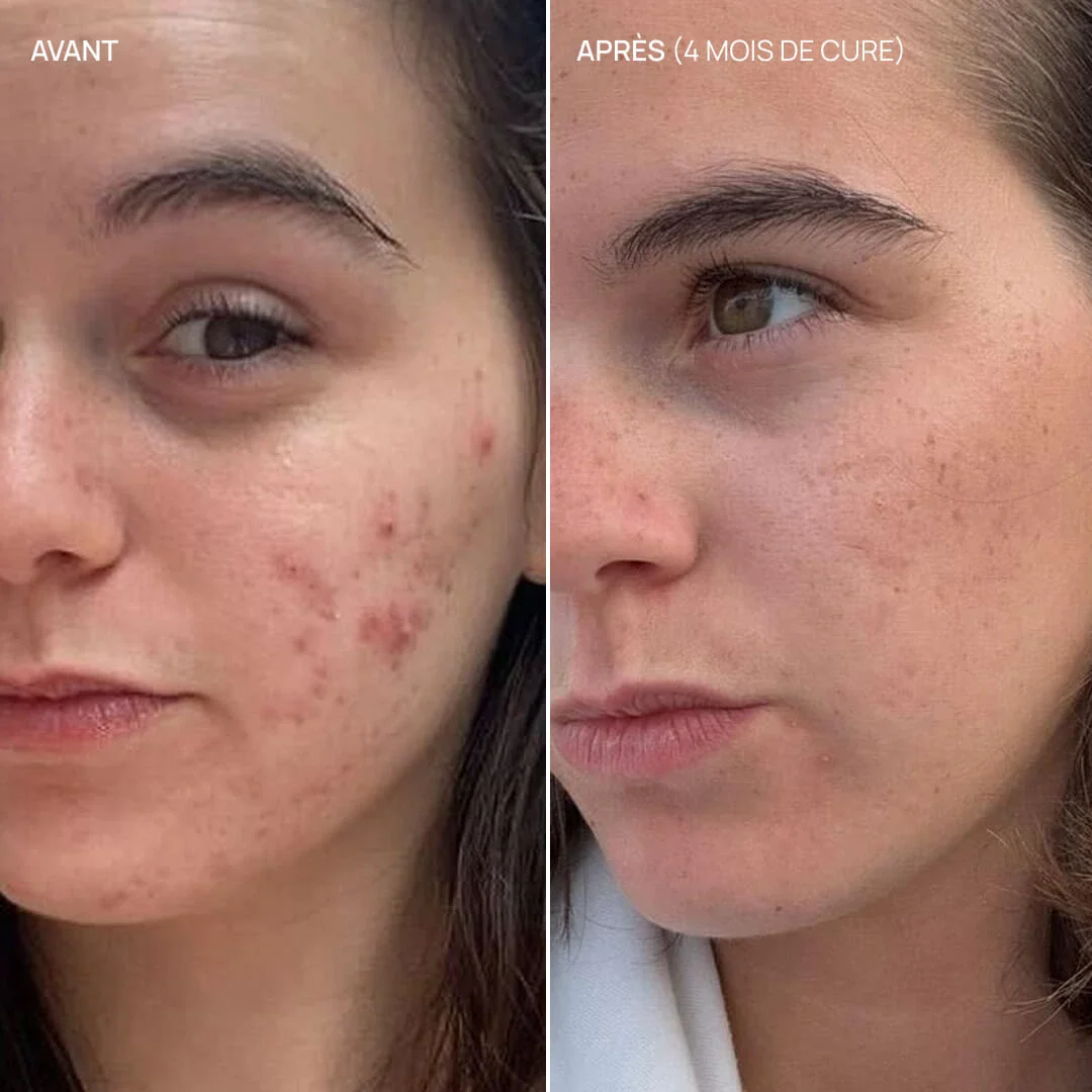 Le duo imperfections - Image 9
